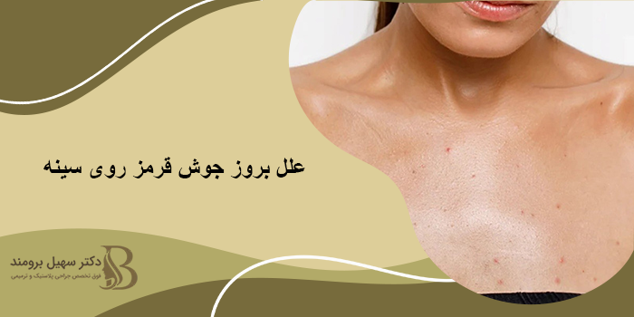 جوش قرمز روی سینه