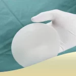 کوچک شدن پروتز سینه بعد از کاشت