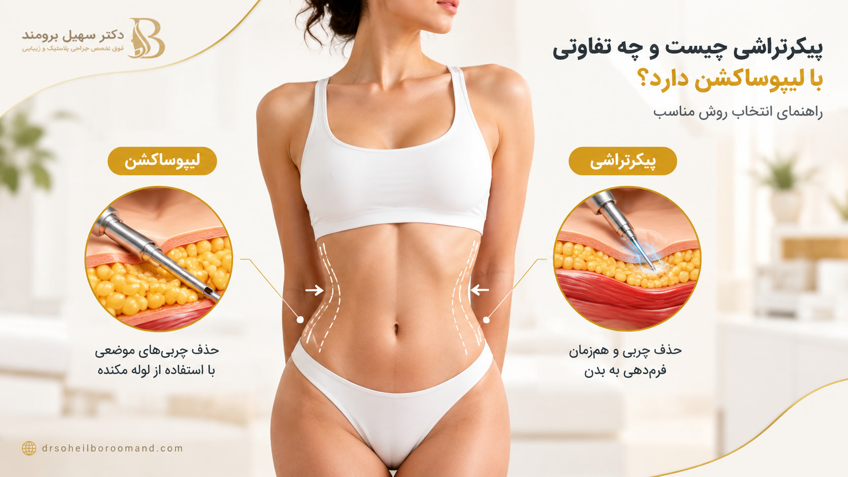پیکرتراشی چیست و چه تفاوتی با لیپوساکشن دارد؟ راهنمای انتخاب روش مناسب